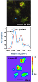 Células neuronales infectadas (Cortesía de L. Miller, NSLS)